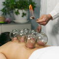 Cupping Therapy
